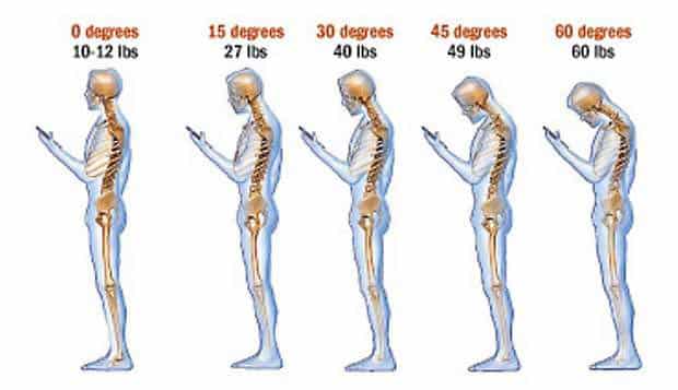 Effects of bad posture on neck and head